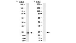 Cytochrome b, Mouse anti-Human, Clone: 5B3-6E3, Millipore Sigma 25&mu;g;